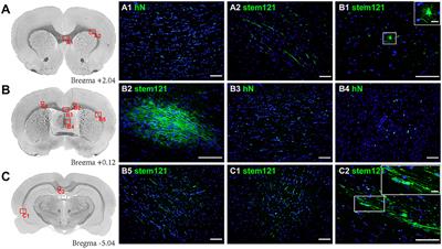 Transplanted Human Oligodendrocyte Progenitor Cells Restore Neurobehavioral Deficits in a Rat Model of Preterm White Matter Injury